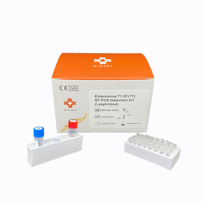 O jogo rápido do teste do enterovírus 71 do PCR do RT liofilizou o jogo da detecção do ADN